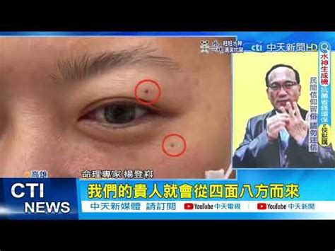 眼瞼痣面相|癦痣面相｜眉上有痣旺夫、眼角有癦多桃花？脫癦前先 